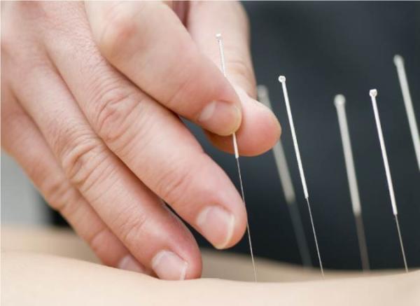 آیا کاهش وزن با طب سوزنی امکانپذیر است؟